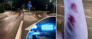 Tonårspojkens vansinnesfärd: Körde på polis