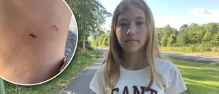 Råtta attackerade Jennifer, 14: "Den bet sig fast"