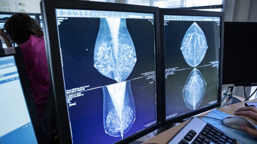 
Läkare granskar bröströntgenbilder, mammografibilder. En studie visar att AI-stöd kan ge goda resultat.
Arkivbild.