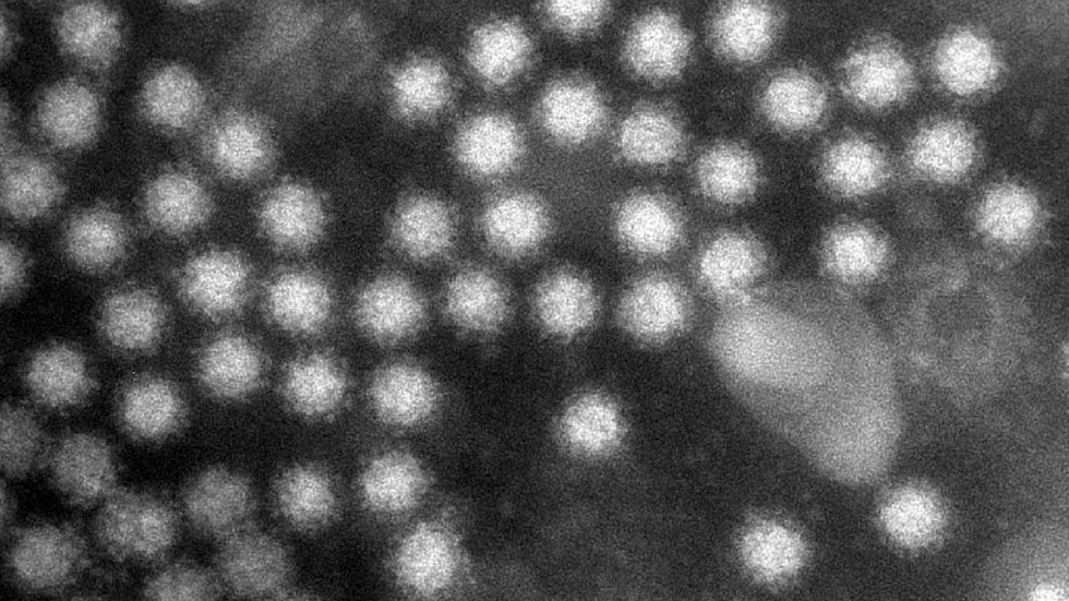 Norovirus – ett mycket smittsamt virus som nu konstaterats i två av de prover som togs under helgen i Enköping.