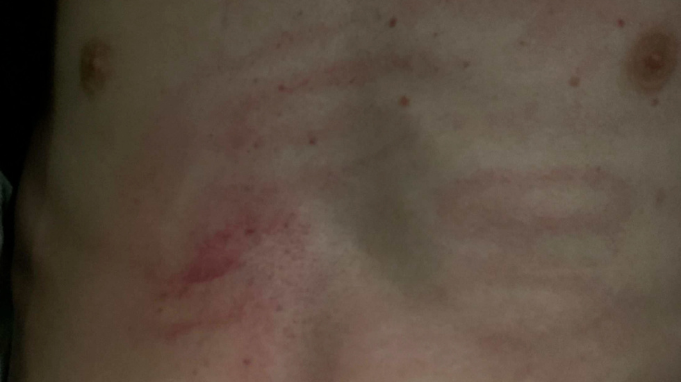 Pojken har i förhör berättat hur slaget i bröstet var så hårt att han fick svårt att andas och det gjorde ont att böja sig framåt. 