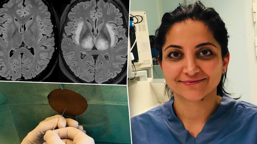 Elham Rostami är neurokirurg vid Akademiska sjukhuset och forskare vid Uppsala universitet.