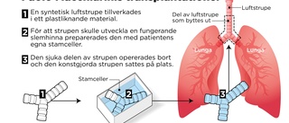 Drömmen om plaststrupen dömd att misslyckas