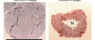 Nytt läkemedel dödar vilande cancercell