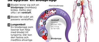 Ökad risk för blodpropp även efter mild covid