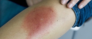 Topp för borreliasmitta under midsommarhelgen