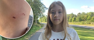 Råtta attackerade Jennifer, 14: "Den bet sig fast"